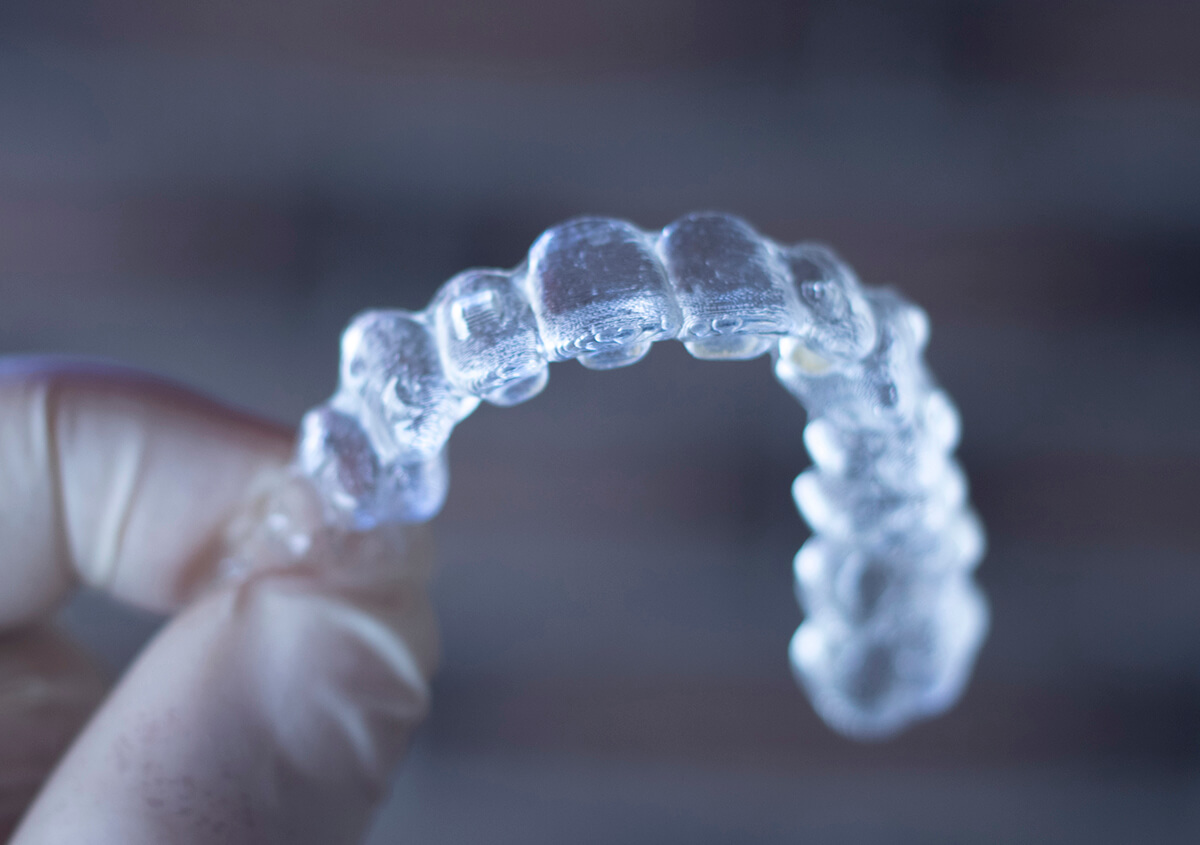 Invisalign Teeth Straightening Treatment in Chalfont PA Area